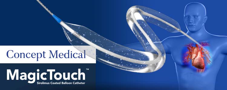 Magic Touch PTCA de Concept Medical | Compañía representada por World Medica