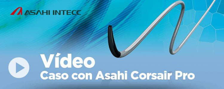 [Vídeo] Presentamos caso realizado con nuestro microcatéter Asahi Corsair Pro